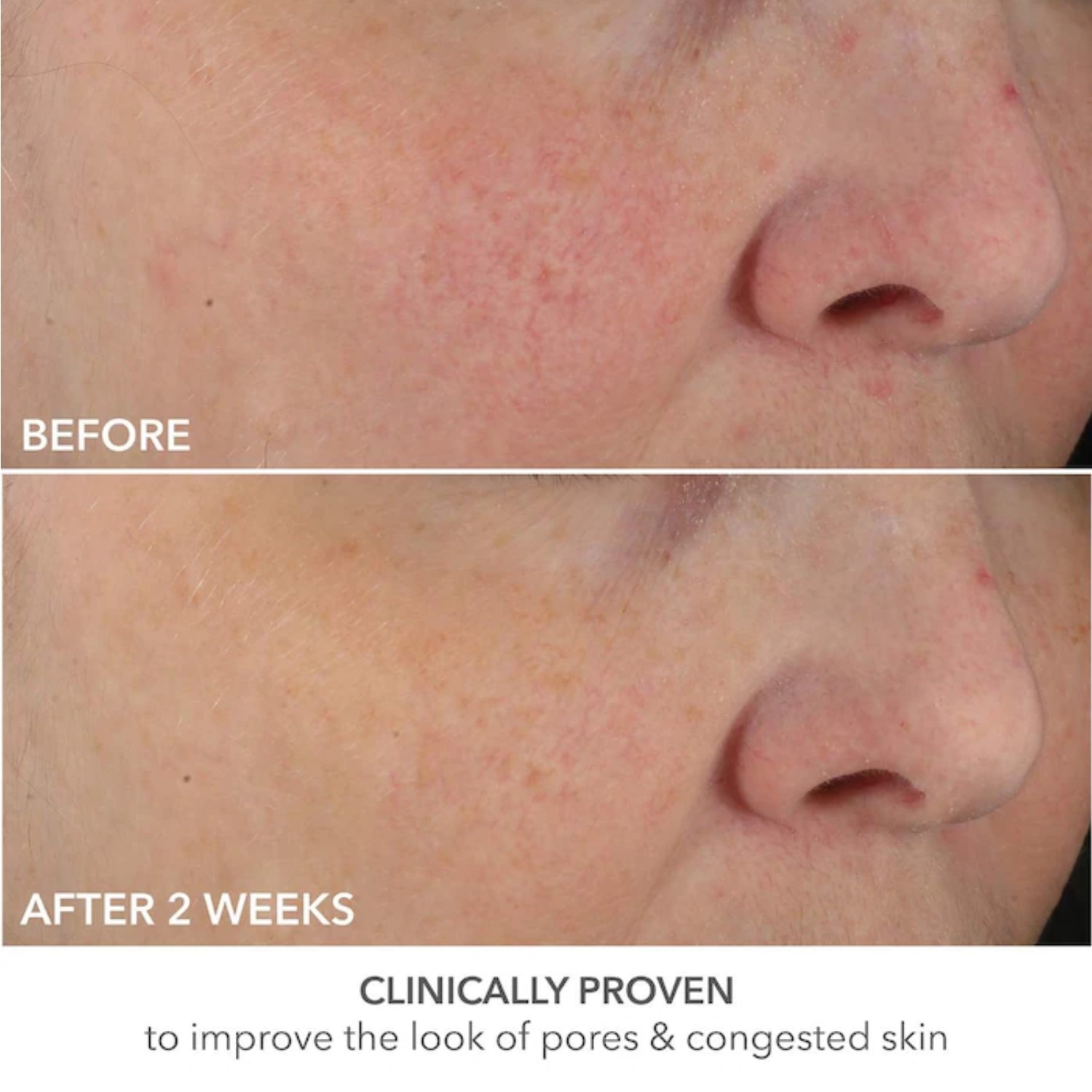 ADVANCED RETINOL + FERULIC PERFECTLY DOSED RETINOL UNIVERSAL 0.2% (ALMOHADILLAS EXFOLIANTES CON RETINOL)